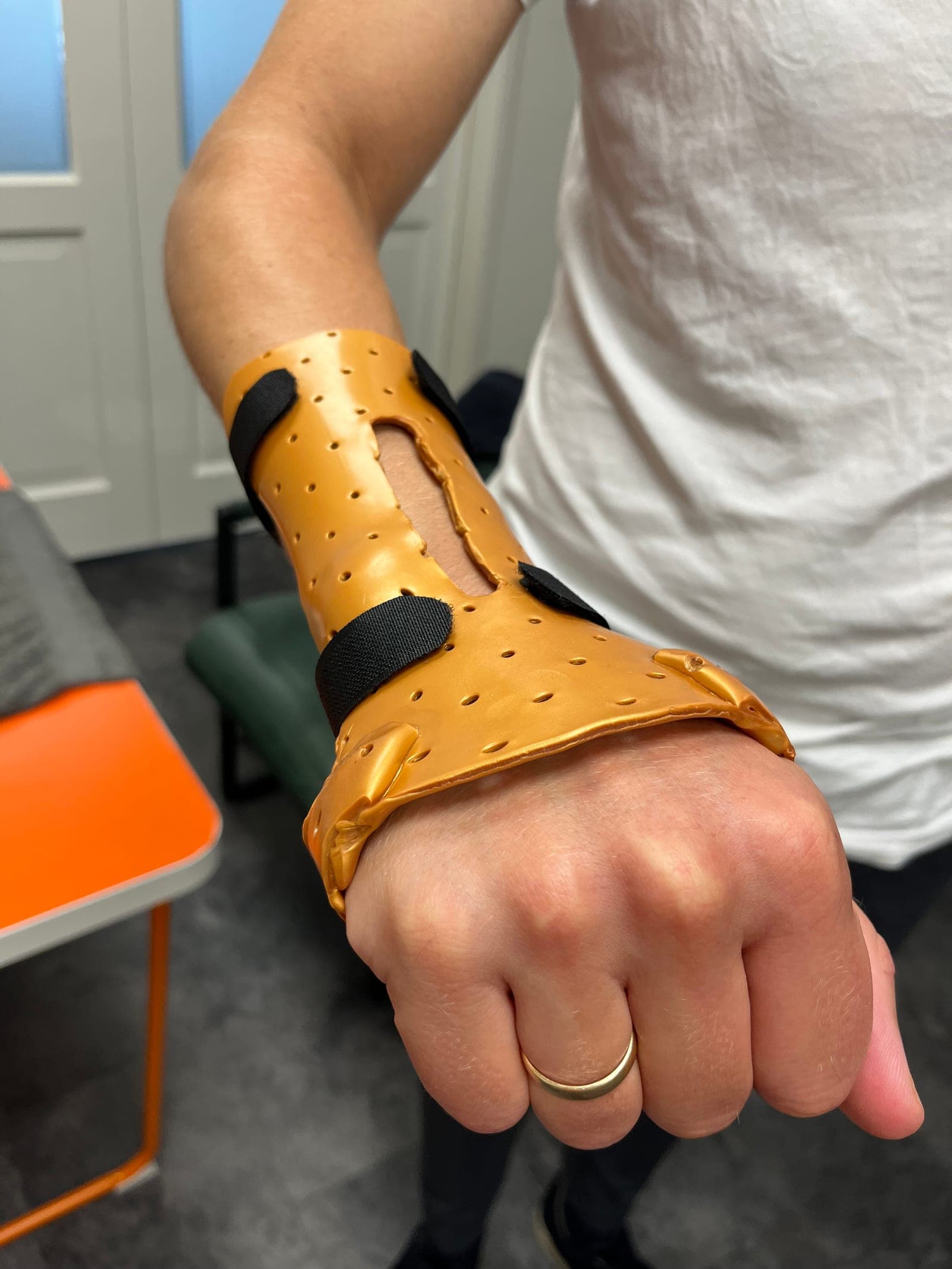Maatwerk gouden spalk in gebruik op de behandeltafel